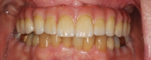 smile gallery image