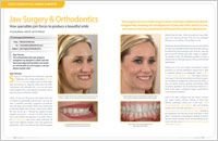 Jaw surgery 1