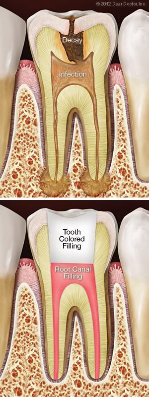 Endodontics 2