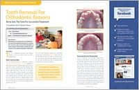 Extractions