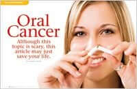 Oral cancer
