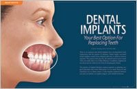 Sinus surgery
