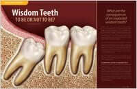 Wisdom teeth