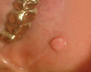 Oral diagnosis