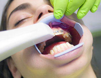 Orthodontic