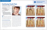 root canal 3