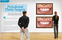 Cosmetic gum 3