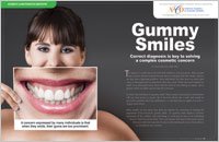 Gummy Smiles 2