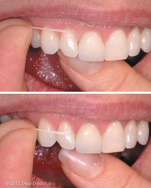 flossing 2