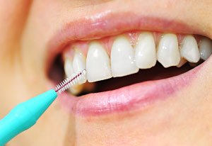 interdental device