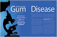 Periodontal treatment