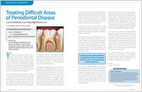 Periodontal treatment