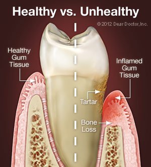 oral health