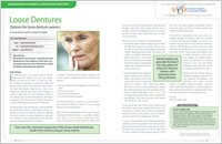 Dentures 7