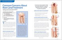 root canal faq2