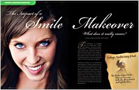 Smile makeover 2