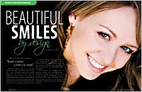 Smile makeover 4