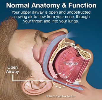 Sleep Apnea