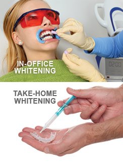 Whitening 2