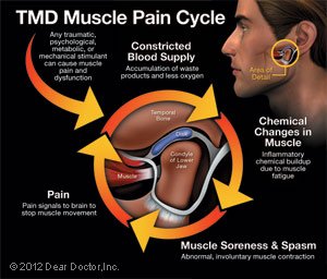 TMD 3