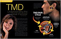 TMD 4
