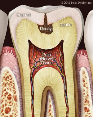 Tooth pain 2