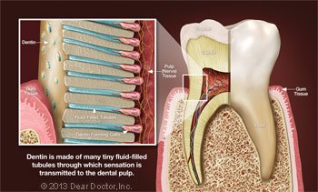 Tooth Sensitivity 2