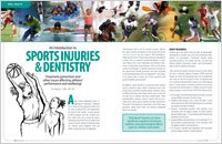 dental injuries
