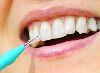 Interdental Cleaning Devices